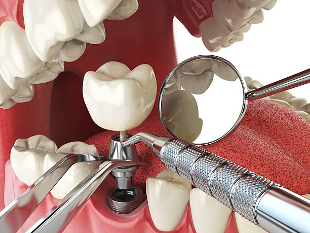 Best Emergency Treatment for Oral Infections in Rose Lodge, OR